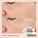 Squalane + Omega Repair Cream – Ultra-Moisturizing Face Cream with Hyaluronic Acid, Ceramides & Squalane for Dry & Sensitive Skin