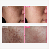 7% Arbutin Dark Spot Cream for Hyperpigmentation, Brightening & Even Skin Tone