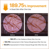 Kojic Acid & Turmeric Exfoliating Body Spray for Brightening, Nourishing & Skin Renewal